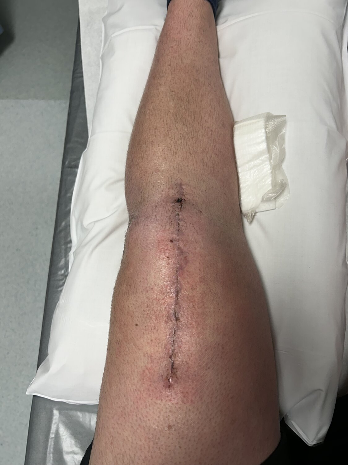 IMG_8393.jpeg IMG_8393.jpeg