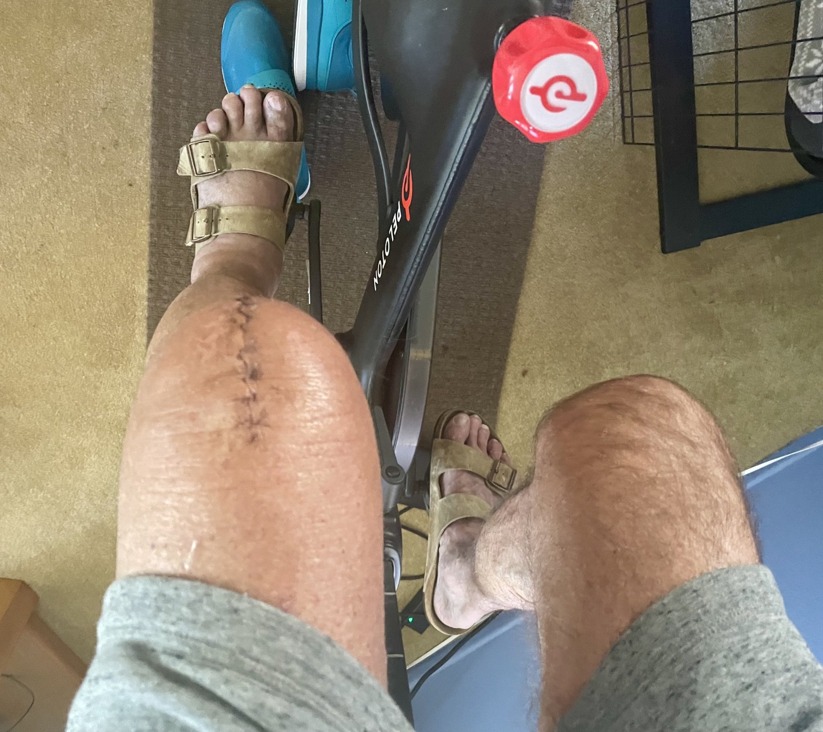 knee pic.jpg