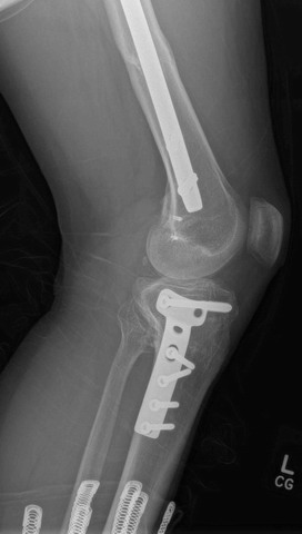 left leg 01 small.jpg