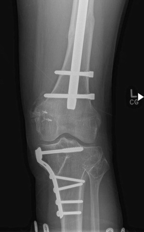 left leg 02 small.jpg