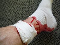 BloodFFail.JPG